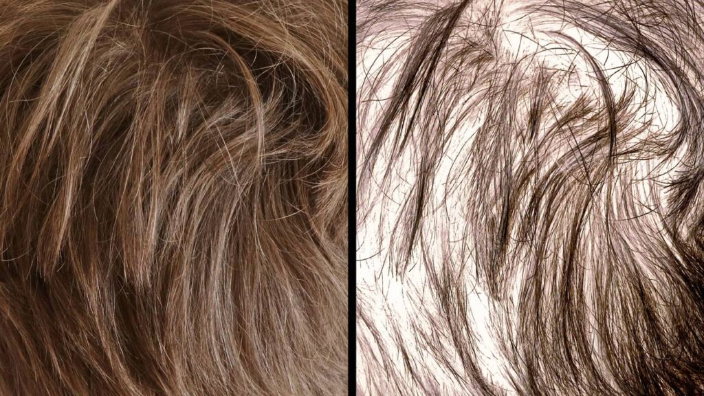 Os 4 tônicos capilares mais utilizados para estimular o crescimento e a densidade do cabelo