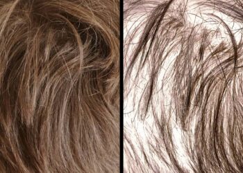 4 plantas que ajudam a fortalecer os fios e a evitar a queda de cabelo