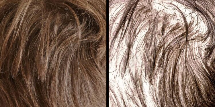 4 plantas que ajudam a fortalecer os fios e a evitar a queda de cabelo