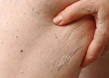 Diga adeus as rugas com esses 4 cremes baratos que tem em toda farmácia