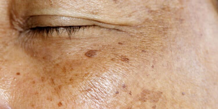 Top 6 cremes faciais baratinhos mais indicados para mulheres com mais de 60 anos