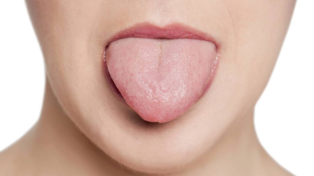 Sua língua pode indicar doenças antes dos sintomas aparecerem