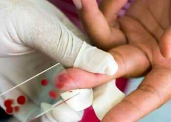 Nova descoberta da IA pode revolucionar o controle da malária