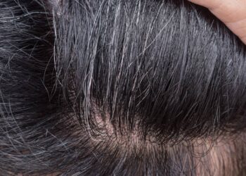 Diga adeus para os cabelos grisalhos, o melhor shampoo baratinho que acaba com os fios brancos