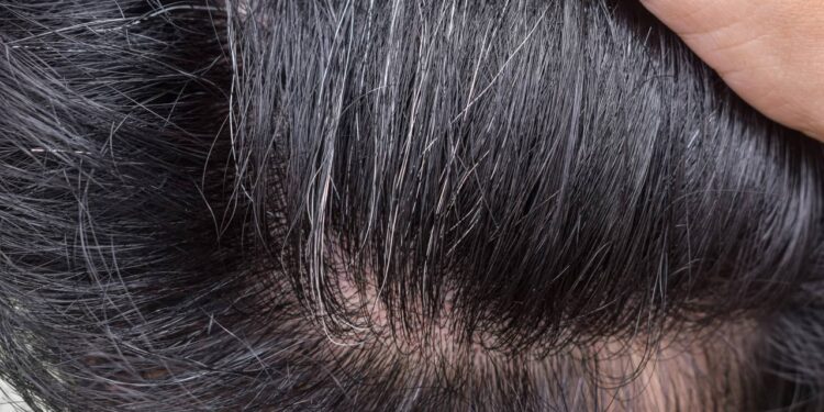 Diga adeus para os cabelos grisalhos, o melhor shampoo baratinho que acaba com os fios brancos