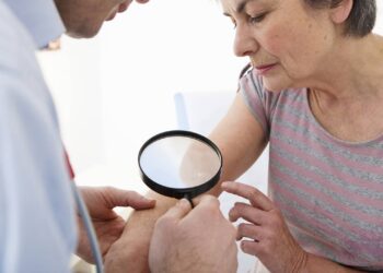 Diga adeus as manchas escuras na pele, o melhor jeito de tratar e prevenir foi descoberto