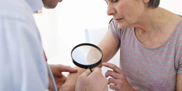 Diga adeus as manchas escuras na pele, o melhor jeito de tratar e prevenir foi descoberto