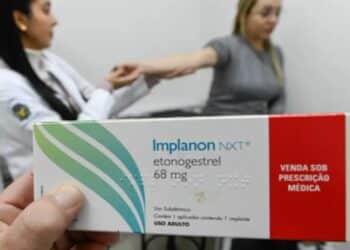 Governo autoriza implante contraceptivo em adolescentes sem necessidade de permissão dos pais