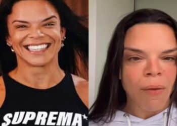 Cirurgia arriscada termina em complicações para personal das estrelas e preocupa fãs