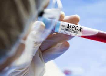 Autoridades alertam população no Carnaval após confirmação de Mpox em Porto Alegre