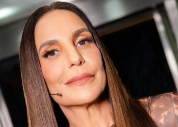 Ivete Sangalo aparece com machucados no rosto, deixa fãs em alerta e estado de saúde é revelado