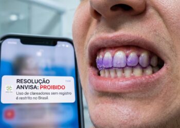 Anvisa proíbe fitas de clareamento dental e manda retirar produtos do mercado