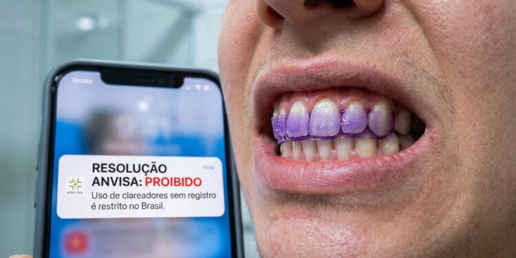 Anvisa proíbe fitas de clareamento dental e manda retirar produtos do mercado