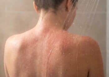 Tomar banho muito quente pode estar prejudicando sua pele mais do que você imagina