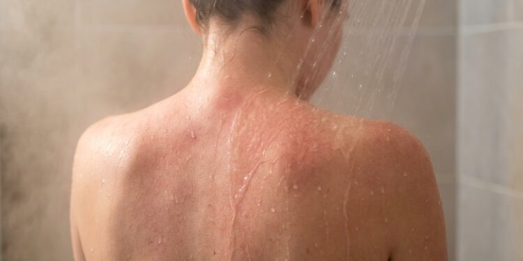 Tomar banho muito quente pode estar prejudicando sua pele mais do que você imagina