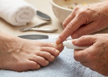 Unhas grossas e duras depois dos 60: como amolecer antes de cortar sem machucar