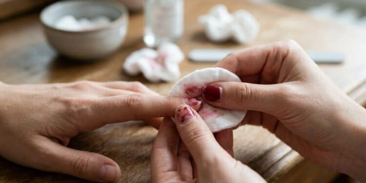 6 soluções caseiras para remover esmalte sem usar removedor de esmalte