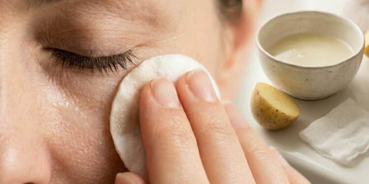 Creme caseiro com suco de batata ajuda a suavizar olheiras e deixar a região dos olhos mais iluminada