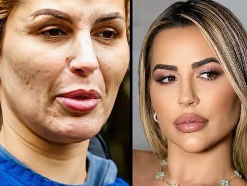 Deolane aparece presa, sem aplique e maquiagem - Foto: Reprodução/Redes Sociais