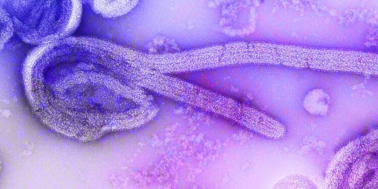 Foto: CDC/Dr. Frederick Murphy